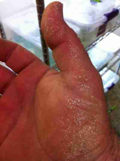 Oxidizing agent burned my skin when not wearing gloves.